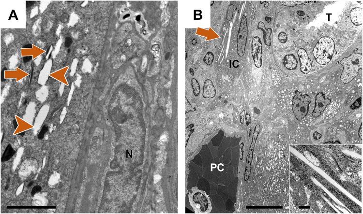 https://cdn.ncbi.nlm.nih.gov/pmc/blobs/4ddd/8041455/a65ad91ba9dd/kfaa191f7.jpg