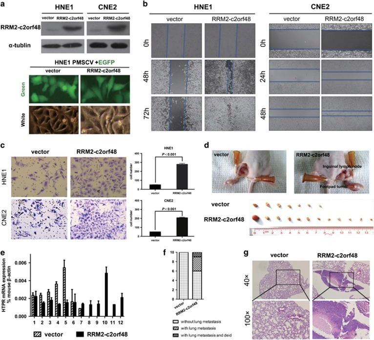 https://cdn.ncbi.nlm.nih.gov/pmc/blobs/4de0/5636969/afe2cfa0ae96/cddis2017402f5.jpg