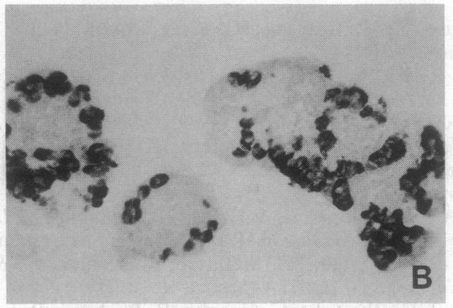 https://cdn.ncbi.nlm.nih.gov/pmc/blobs/4de4/53081/f7312f3270ac/pnas01074-0132-b.jpg