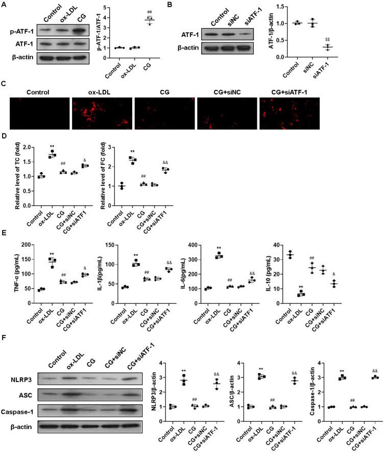 https://cdn.ncbi.nlm.nih.gov/pmc/blobs/4def/12039851/cae3cd3bf90e/JIR-18-5573-g0004.jpg