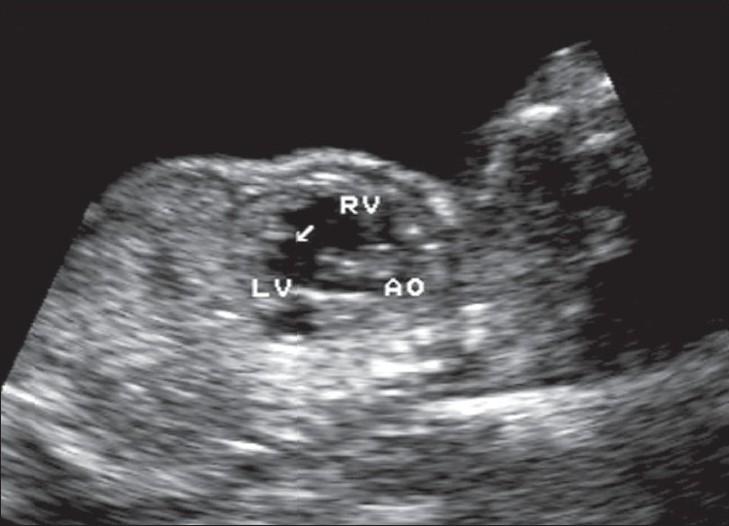https://cdn.ncbi.nlm.nih.gov/pmc/blobs/4df8/2747463/c54680ac73ac/IJRI-18-352-g005.jpg
