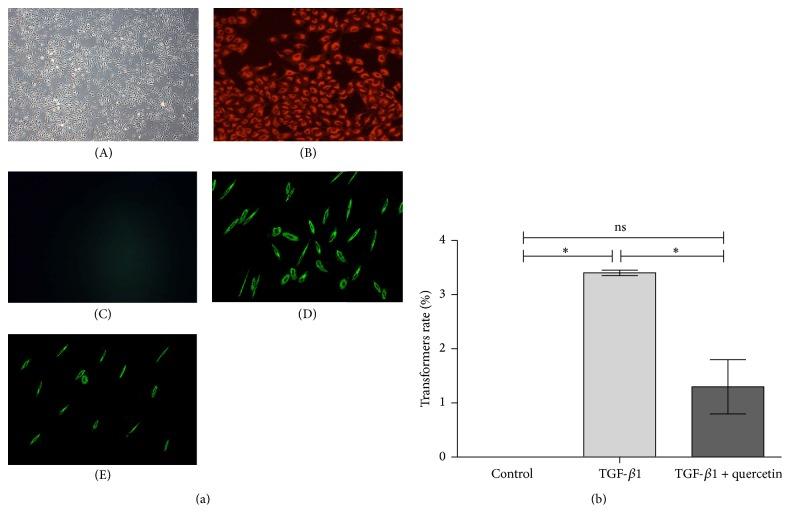 https://cdn.ncbi.nlm.nih.gov/pmc/blobs/4dfd/5385898/36bbc82a1a5e/BMRI2017-6147294.003.jpg