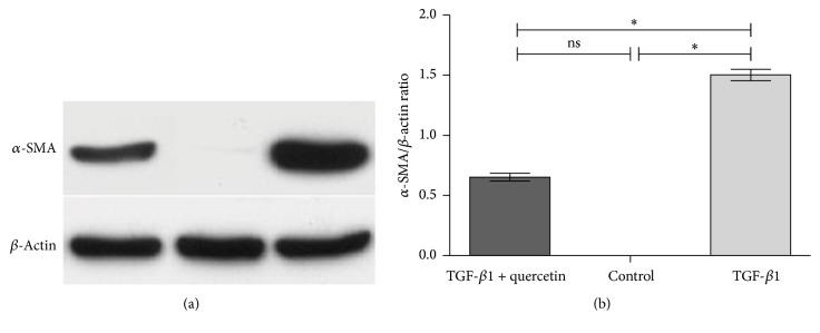 https://cdn.ncbi.nlm.nih.gov/pmc/blobs/4dfd/5385898/7f01714eafa2/BMRI2017-6147294.004.jpg