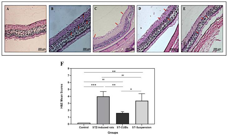 https://cdn.ncbi.nlm.nih.gov/pmc/blobs/4e00/10610393/7331fbe21603/pharmaceutics-15-02419-g007.jpg