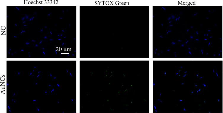 https://cdn.ncbi.nlm.nih.gov/pmc/blobs/4e0c/7457724/a126a5b405e6/IJN-15-6401-g0003.jpg
