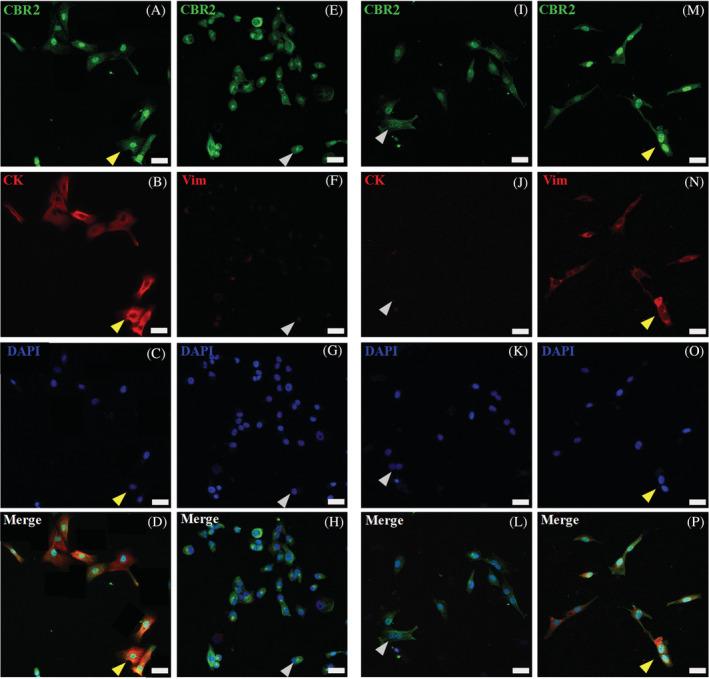https://cdn.ncbi.nlm.nih.gov/pmc/blobs/4e0c/9308437/77bb11e68899/JVIM-36-1508-g003.jpg