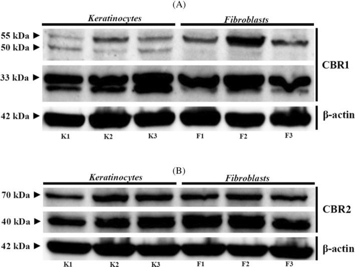 https://cdn.ncbi.nlm.nih.gov/pmc/blobs/4e0c/9308437/a6a642efce5a/JVIM-36-1508-g001.jpg