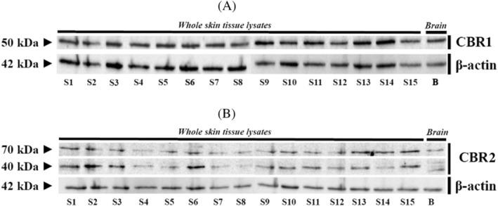 https://cdn.ncbi.nlm.nih.gov/pmc/blobs/4e0c/9308437/d6a583c67c30/JVIM-36-1508-g008.jpg
