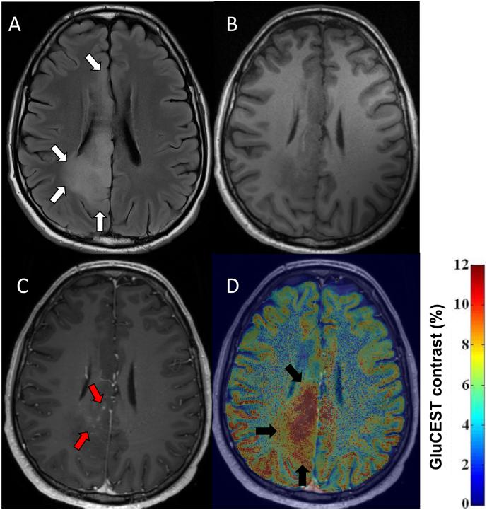 https://cdn.ncbi.nlm.nih.gov/pmc/blobs/4e0e/6396013/0bae54f777c8/gr2.jpg