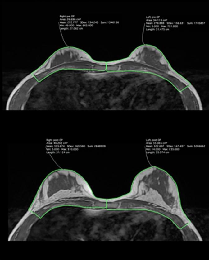https://cdn.ncbi.nlm.nih.gov/pmc/blobs/4e15/7581442/6c1cfba2fa09/SCT3-9-1277-g002.jpg