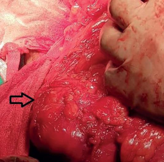 https://cdn.ncbi.nlm.nih.gov/pmc/blobs/4e16/7780799/985c6a993469/medarch-74-393-g003.jpg