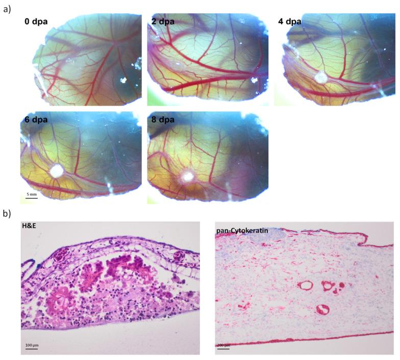 https://cdn.ncbi.nlm.nih.gov/pmc/blobs/4e17/8946779/3736bb1ff0a3/cancers-14-01476-g005.jpg