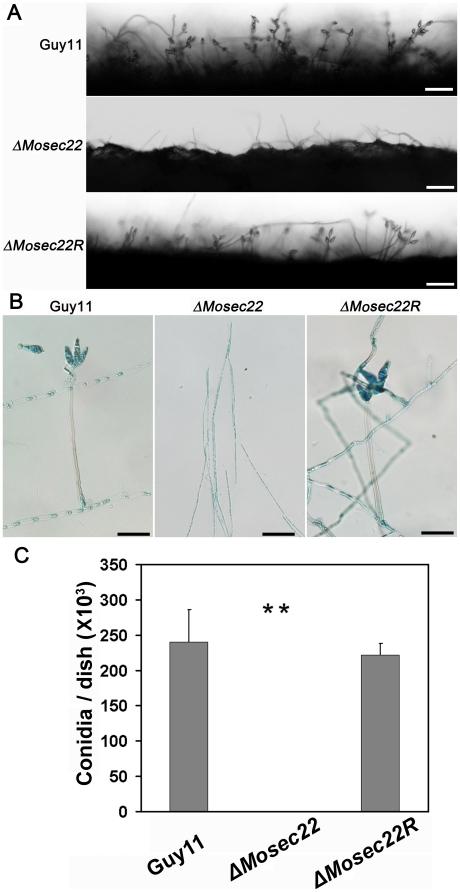 https://cdn.ncbi.nlm.nih.gov/pmc/blobs/4e1c/2950850/3555ce3470bf/pone.0013193.g004.jpg