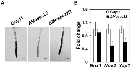 https://cdn.ncbi.nlm.nih.gov/pmc/blobs/4e1c/2950850/da316d4df71f/pone.0013193.g009.jpg