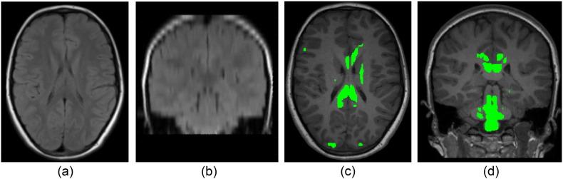 https://cdn.ncbi.nlm.nih.gov/pmc/blobs/4e20/4908311/56cb860710b7/gr4.jpg