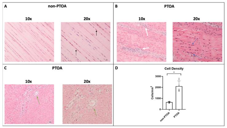 https://cdn.ncbi.nlm.nih.gov/pmc/blobs/4e2f/10526460/510445954c12/biomolecules-13-01416-g004.jpg