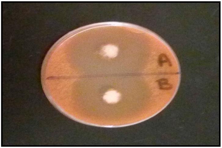 https://cdn.ncbi.nlm.nih.gov/pmc/blobs/4e30/5874839/43461ab1a230/pharmaceutics-10-00026-g010.jpg
