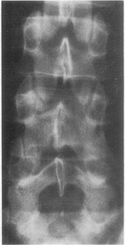 https://cdn.ncbi.nlm.nih.gov/pmc/blobs/4e34/1000219/112ab6ee7221/annrheumd00085-0062-a.jpg