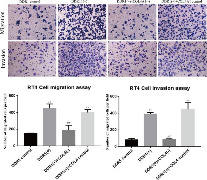 https://cdn.ncbi.nlm.nih.gov/pmc/blobs/4e3d/7705183/222552305f83/10.1177_1533033820973277-fig7.jpg