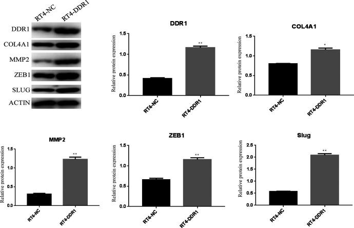 https://cdn.ncbi.nlm.nih.gov/pmc/blobs/4e3d/7705183/b5100b221b1a/10.1177_1533033820973277-fig4.jpg