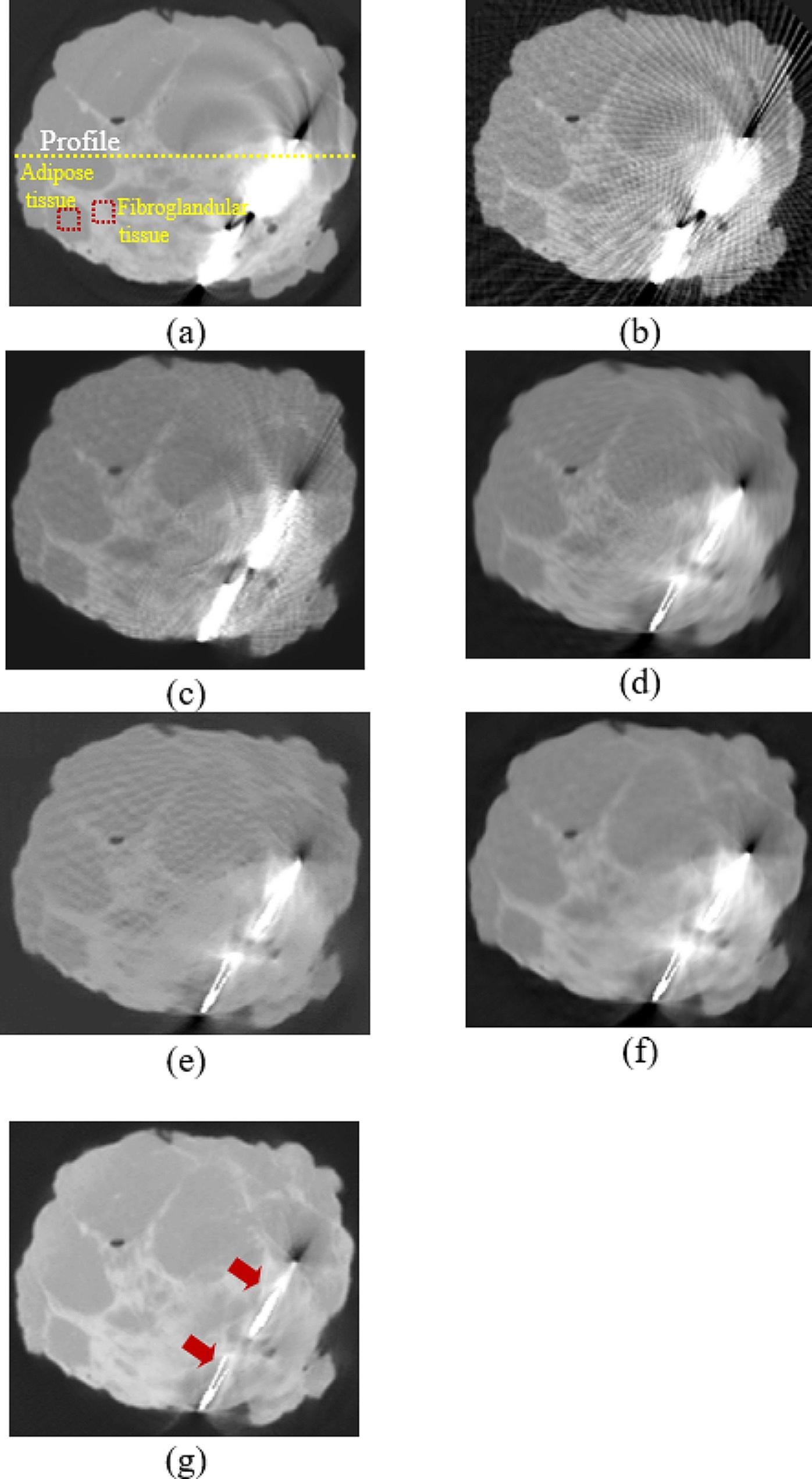 https://cdn.ncbi.nlm.nih.gov/pmc/blobs/4e3e/10845762/e712fae82739/12880_2024_1216_Figm_HTML.jpg