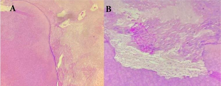https://cdn.ncbi.nlm.nih.gov/pmc/blobs/4e44/9869013/e1137d27d9a0/IEJ-17-151-g003.jpg
