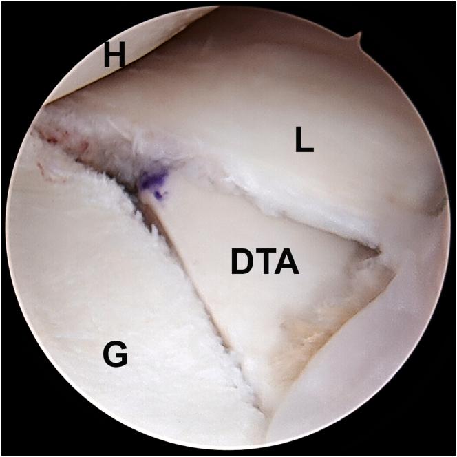 https://cdn.ncbi.nlm.nih.gov/pmc/blobs/4e4a/12177479/4011adc1d0d3/gr5.jpg