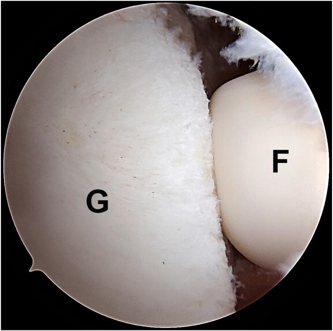 https://cdn.ncbi.nlm.nih.gov/pmc/blobs/4e4a/12177479/a5054853660c/gr4.jpg