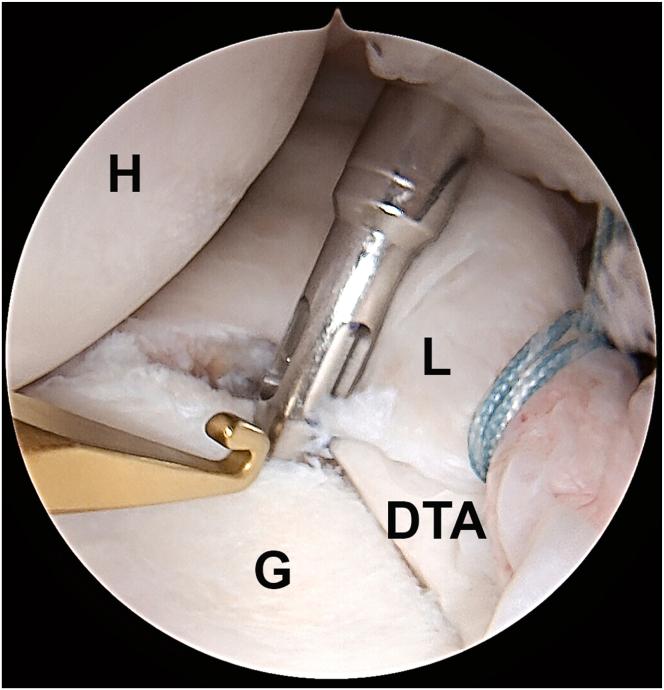 https://cdn.ncbi.nlm.nih.gov/pmc/blobs/4e4a/12177479/dbd0fd85956e/gr6.jpg