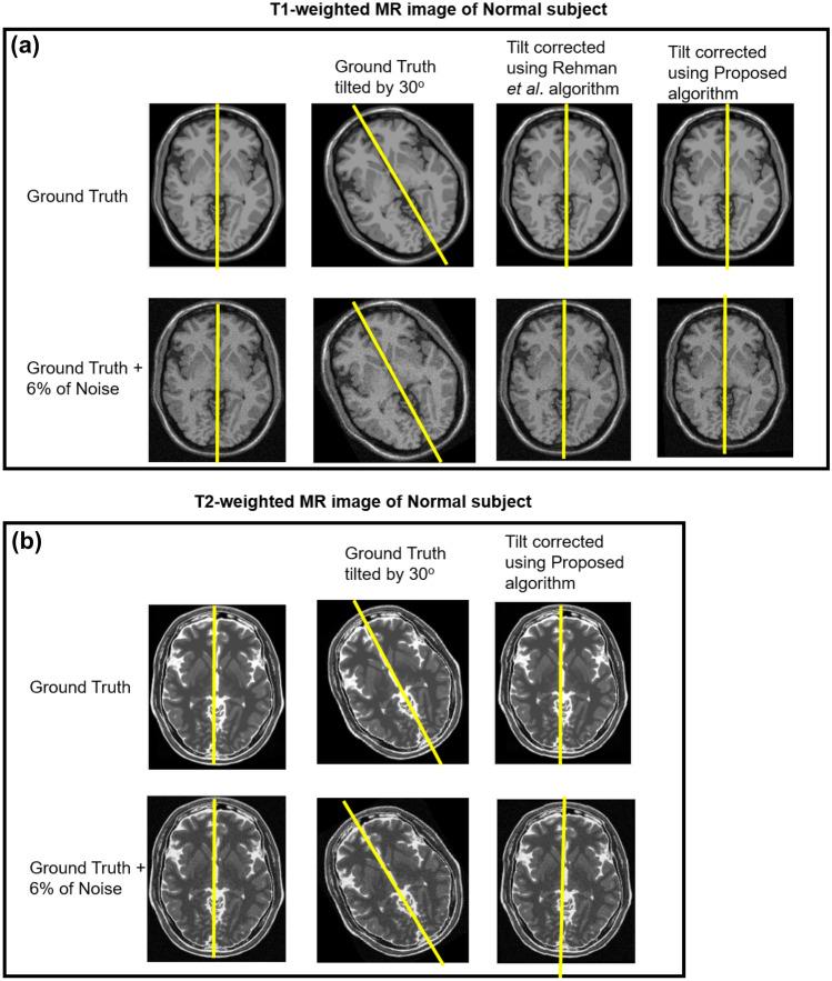 https://cdn.ncbi.nlm.nih.gov/pmc/blobs/4e5b/8329139/935d95ebce7b/10278_2020_400_Fig8_HTML.jpg