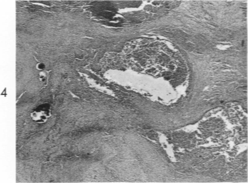 https://cdn.ncbi.nlm.nih.gov/pmc/blobs/4e5c/1942223/96aeb0f55b8d/amjpathol00355-0084-a.jpg