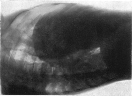 https://cdn.ncbi.nlm.nih.gov/pmc/blobs/4e5e/503458/211f7ece7c0f/brheartj00442-0054-c.jpg