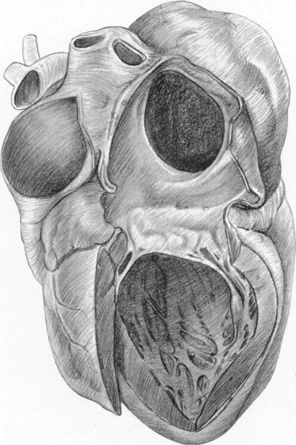 https://cdn.ncbi.nlm.nih.gov/pmc/blobs/4e5e/503458/3d581ead5d80/brheartj00442-0047-a.jpg