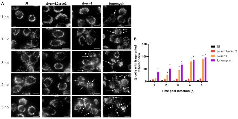 https://cdn.ncbi.nlm.nih.gov/pmc/blobs/4e65/11051933/b749ce0165cd/microorganisms-12-00813-g002.jpg