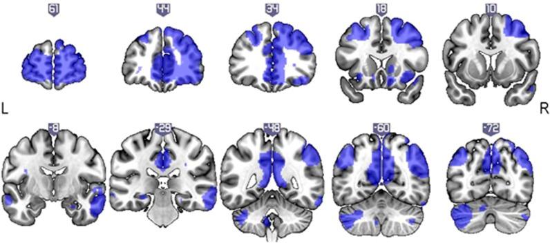 https://cdn.ncbi.nlm.nih.gov/pmc/blobs/4e70/4748419/1025c931e2ab/npp2015208f3.jpg
