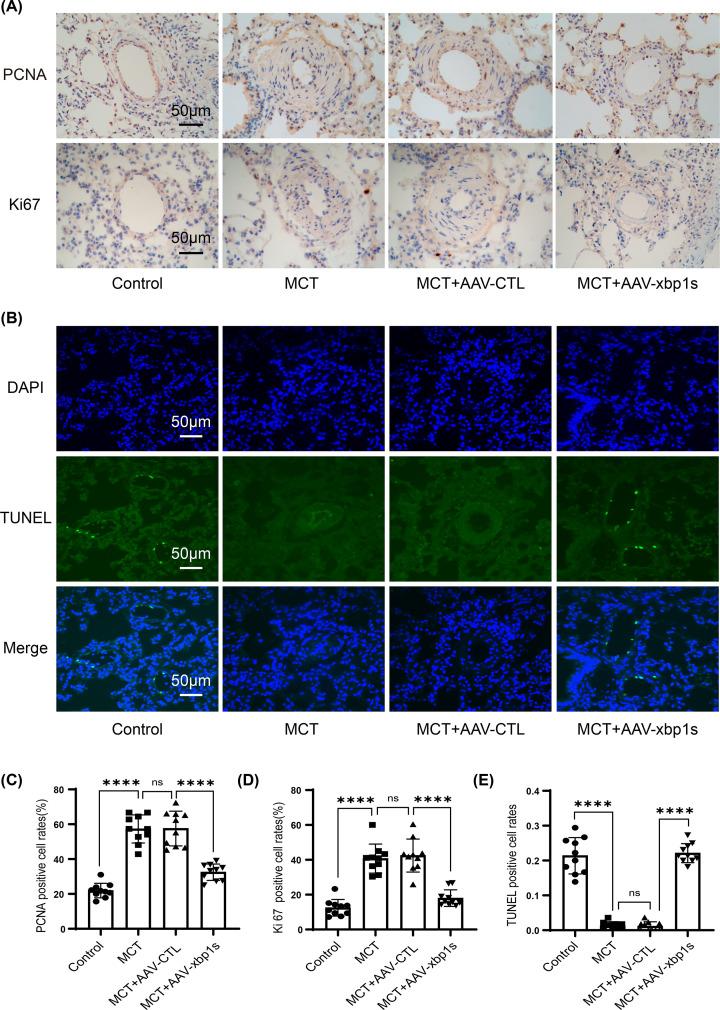 https://cdn.ncbi.nlm.nih.gov/pmc/blobs/4e76/8564003/87adbdf8fbc2/cs-135-cs20210612-g3.jpg