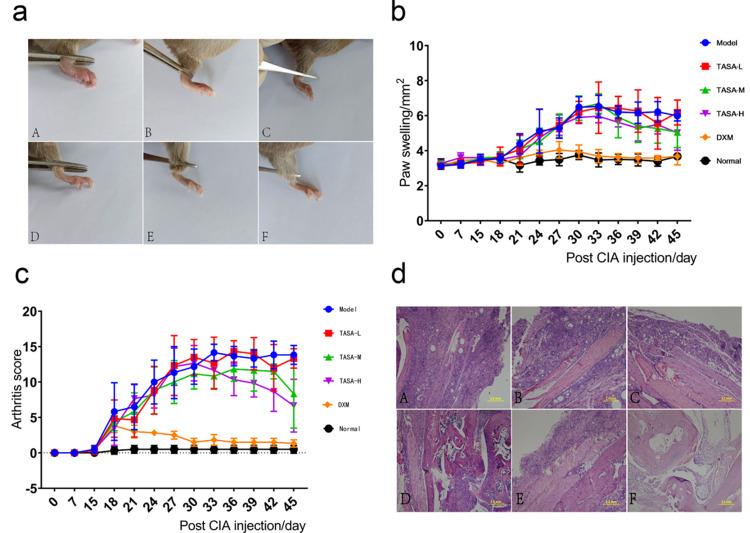 https://cdn.ncbi.nlm.nih.gov/pmc/blobs/4e77/11162965/a8a746a9625d/JIR-17-3587-g0004.jpg