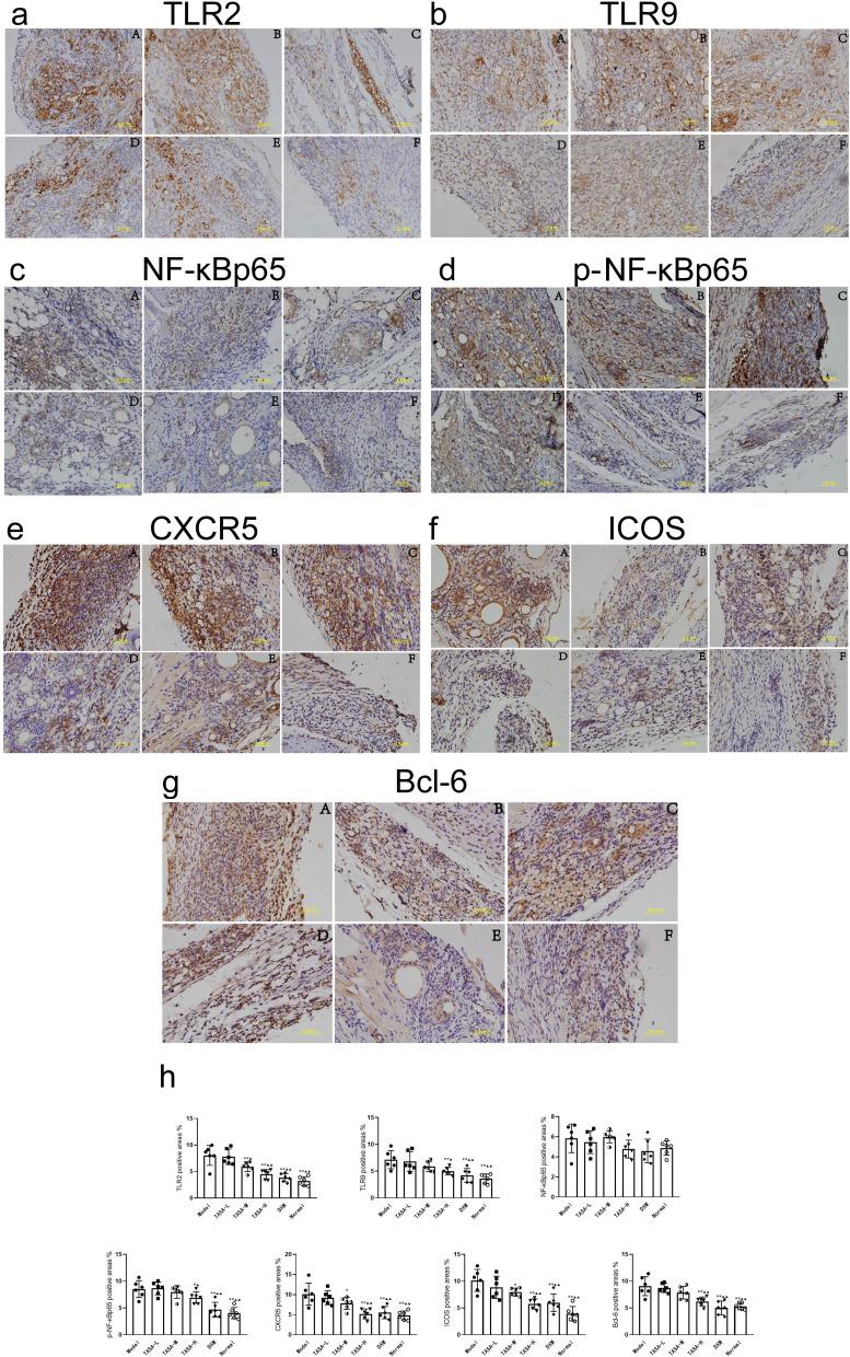 https://cdn.ncbi.nlm.nih.gov/pmc/blobs/4e77/11162965/e4ef9192ecbb/JIR-17-3587-g0008.jpg