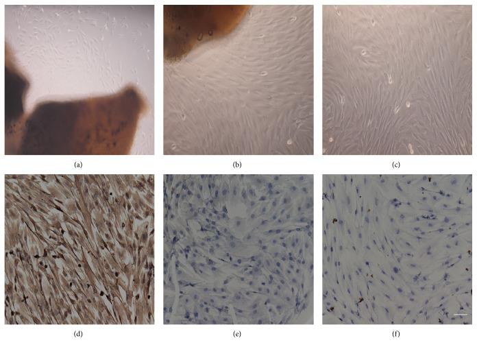 https://cdn.ncbi.nlm.nih.gov/pmc/blobs/4e7d/4877496/98761d36dd57/JOPH2016-5126560.003.jpg