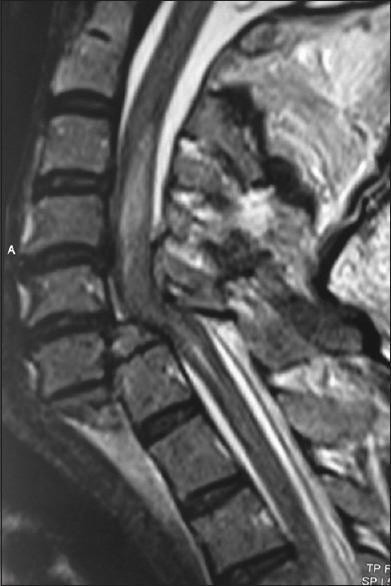 https://cdn.ncbi.nlm.nih.gov/pmc/blobs/4e7d/7057898/5ba354e12759/AJNS-15-222-g001.jpg