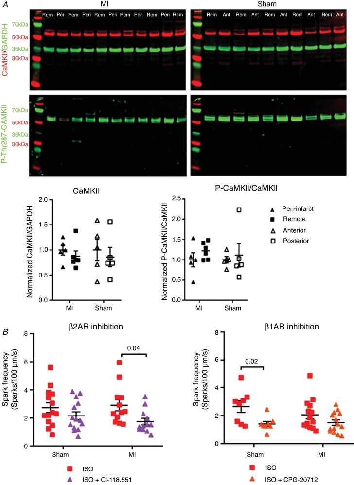 https://cdn.ncbi.nlm.nih.gov/pmc/blobs/4e86/7496440/d0da1e26bc0b/TJP-598-2875-g012.jpg