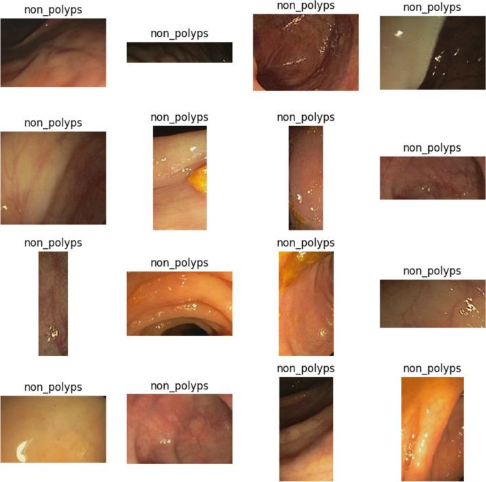 https://cdn.ncbi.nlm.nih.gov/pmc/blobs/4e8b/11763007/1a80989f517e/41598_2025_86590_Fig2_HTML.jpg