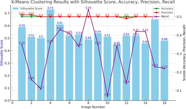 https://cdn.ncbi.nlm.nih.gov/pmc/blobs/4e8b/11763007/4b4886d08806/41598_2025_86590_Fig28_HTML.jpg