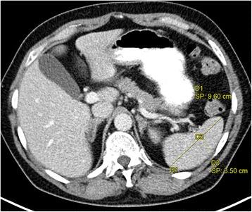 https://cdn.ncbi.nlm.nih.gov/pmc/blobs/4e8d/4722630/96a6b81fc62d/12911_2016_248_Fig3_HTML.jpg
