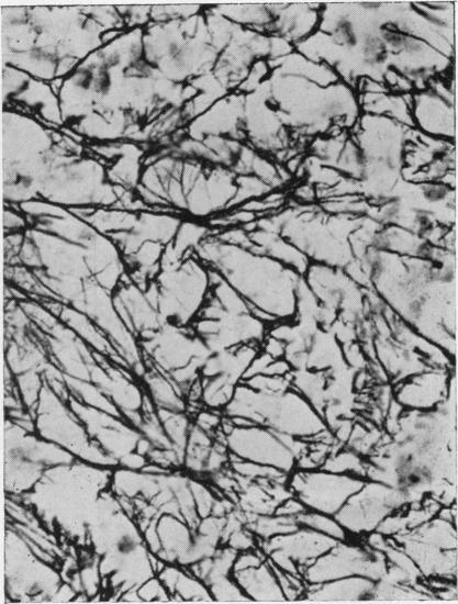 https://cdn.ncbi.nlm.nih.gov/pmc/blobs/4e93/480811/e17e075c6e9e/jclinpath00082-0067-d.jpg