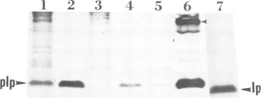 https://cdn.ncbi.nlm.nih.gov/pmc/blobs/4e9c/555092/f0c9fba774e8/emboj00254-0087-b.jpg