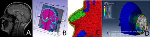 https://cdn.ncbi.nlm.nih.gov/pmc/blobs/4ea2/5897925/ce3e7937a958/12938_2018_470_Fig4_HTML.jpg