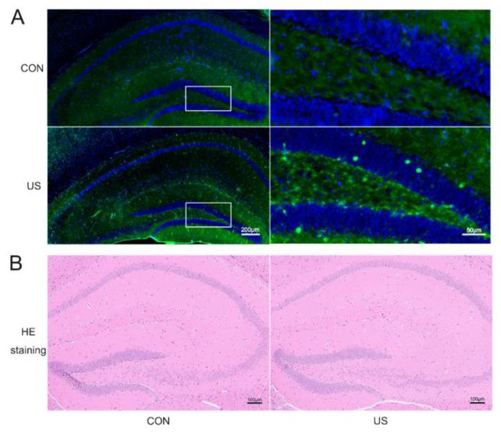 https://cdn.ncbi.nlm.nih.gov/pmc/blobs/4ea5/10137221/c19df8f88939/brainsci-13-00657-g002.jpg