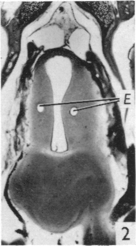 https://cdn.ncbi.nlm.nih.gov/pmc/blobs/4ea6/1351695/2107d9b366a4/jphysiol01106-0208-b.jpg