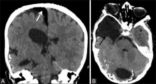 https://cdn.ncbi.nlm.nih.gov/pmc/blobs/4eb2/7546286/133d3736ff2e/IJRI-30-195-g023.jpg